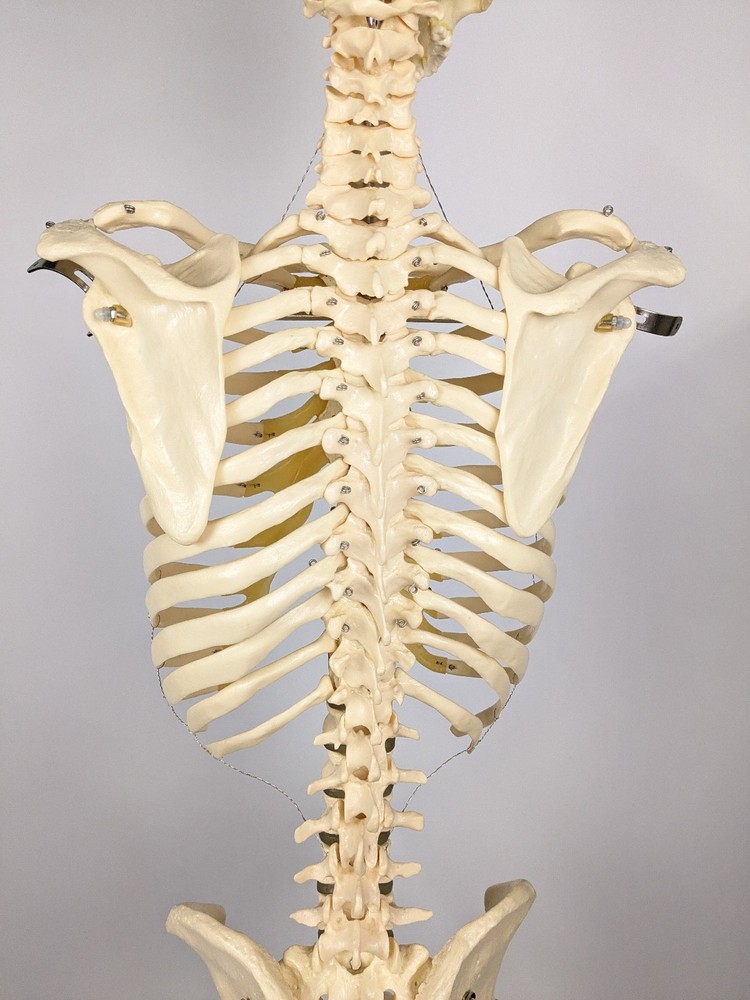 Somso Human Skeleton Anatomical Model with Rolling Stand Base