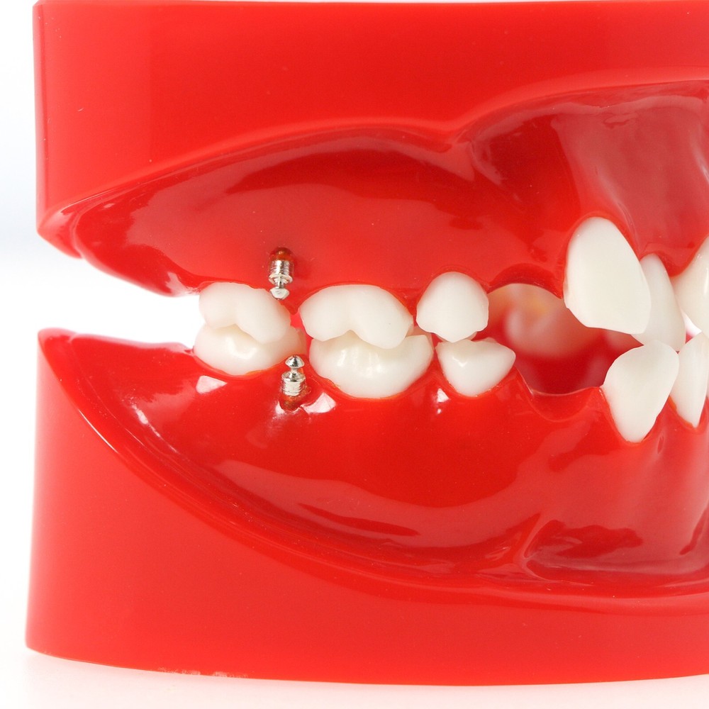Dental for Orthodontics Teach Study Treatment Model M3005