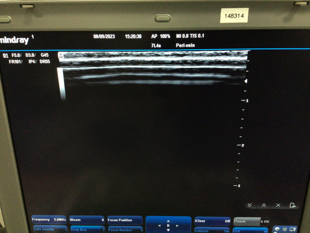 Mindray 7L4s Linear Array Ultrasound Probe