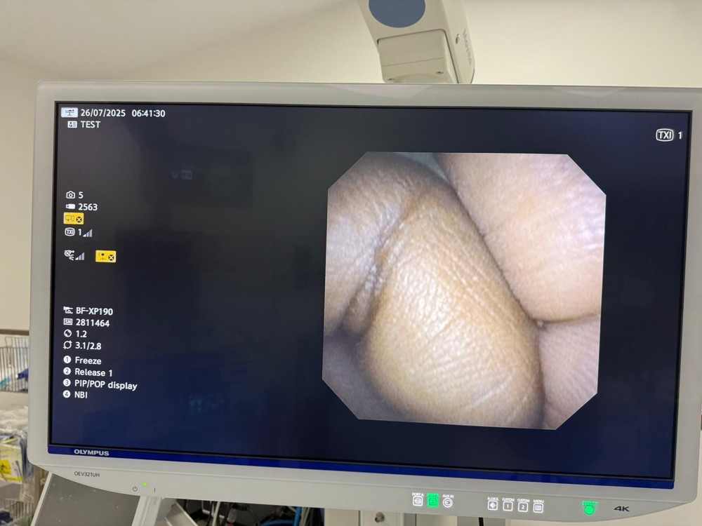 BF-XP190 Bronchoscope Overhauled