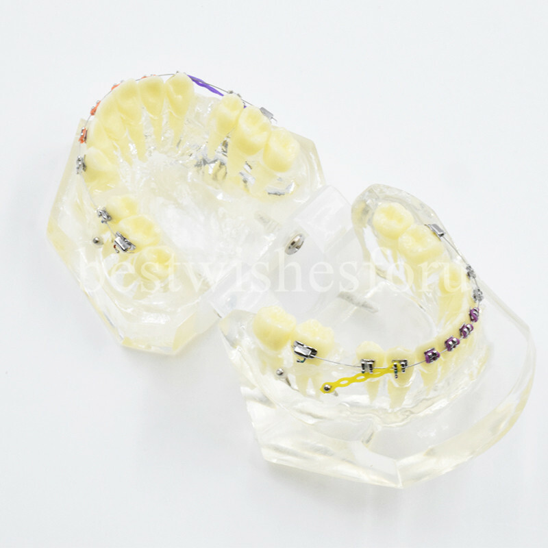 Dental Malocclusion Treatment Teeth Model Study Typodont Elastic chain 3005-2