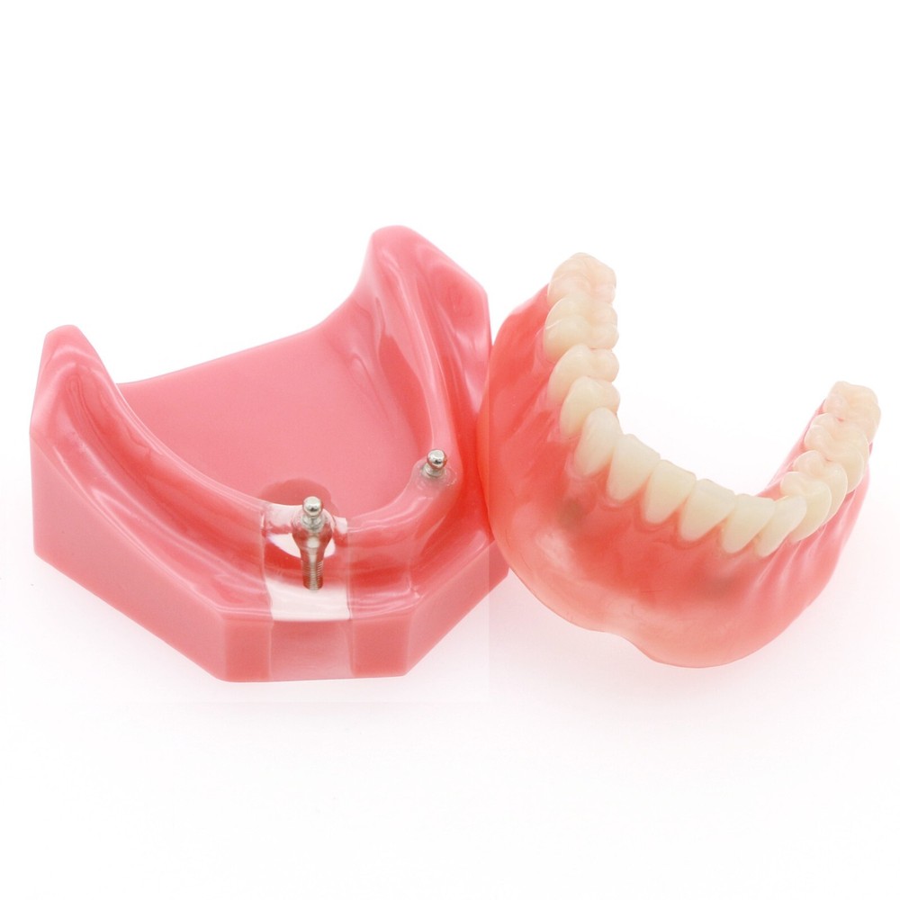Multi Types Dental Typodont Teeth Model Implant Pathological Perio Practice Demo