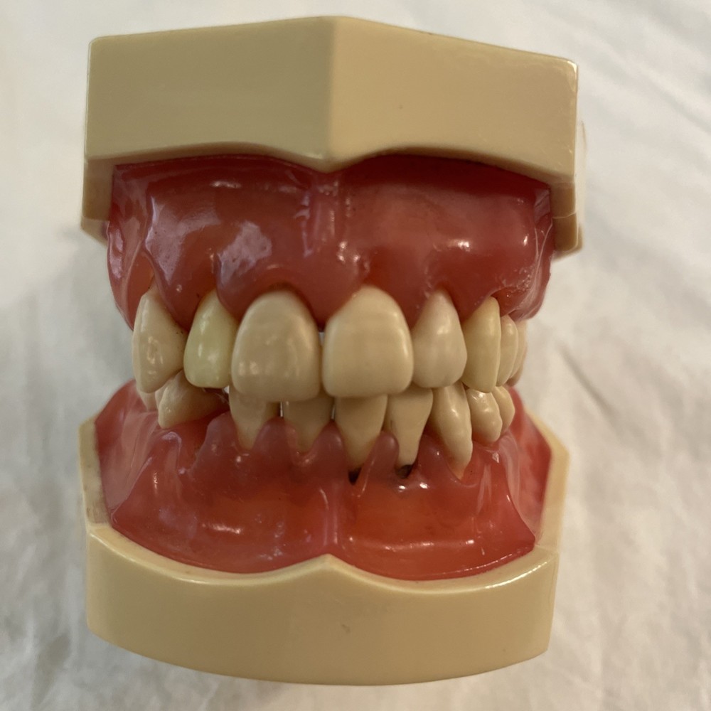 Dental Typodont Model Removable Teeth    PARTS ONLY
