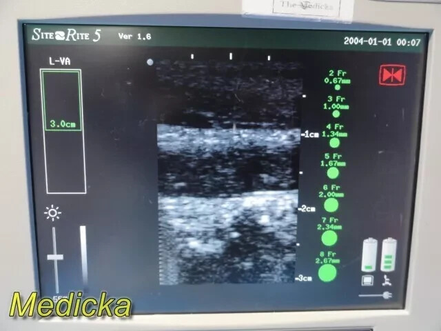 Chison Medical SR-6 Linear Array Vascular (L-VA) Imaging Probe ~ 36097