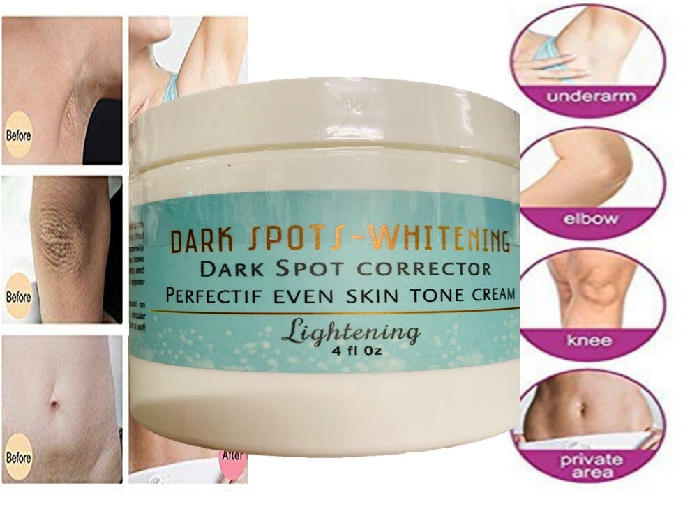 Dark Spot Cream 4oz Spot Corrector Remover support Face Lightening