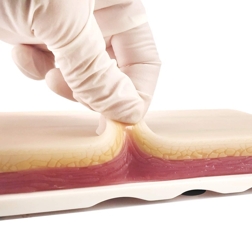 Realistic IV Injection Training Pad with 4 Embedded Veins & Blood Return Feature