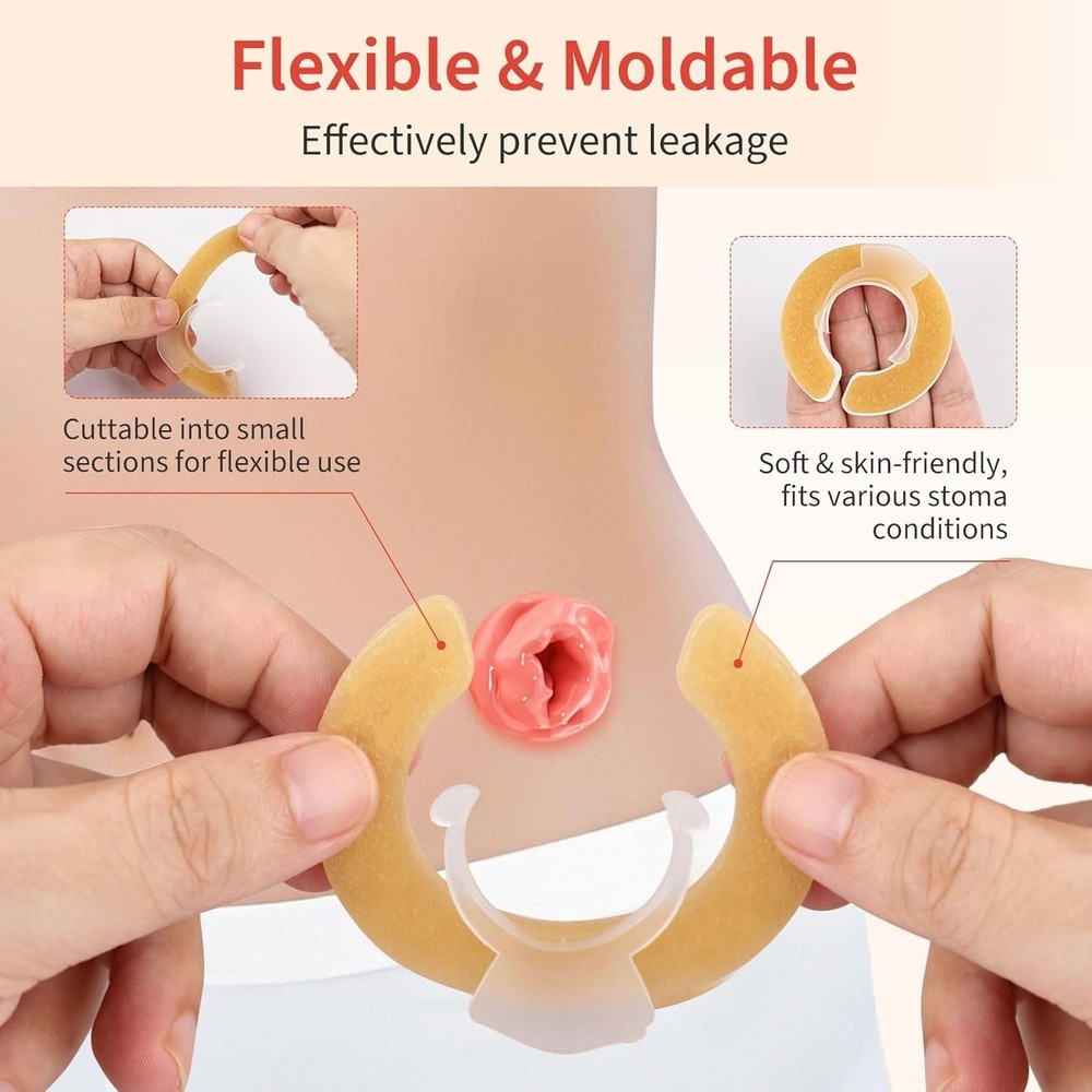 20 PACK Ostomy Barrier Rings, Outer Diameter 1.8" (45mm) 4mm Thick Hydrocolloid