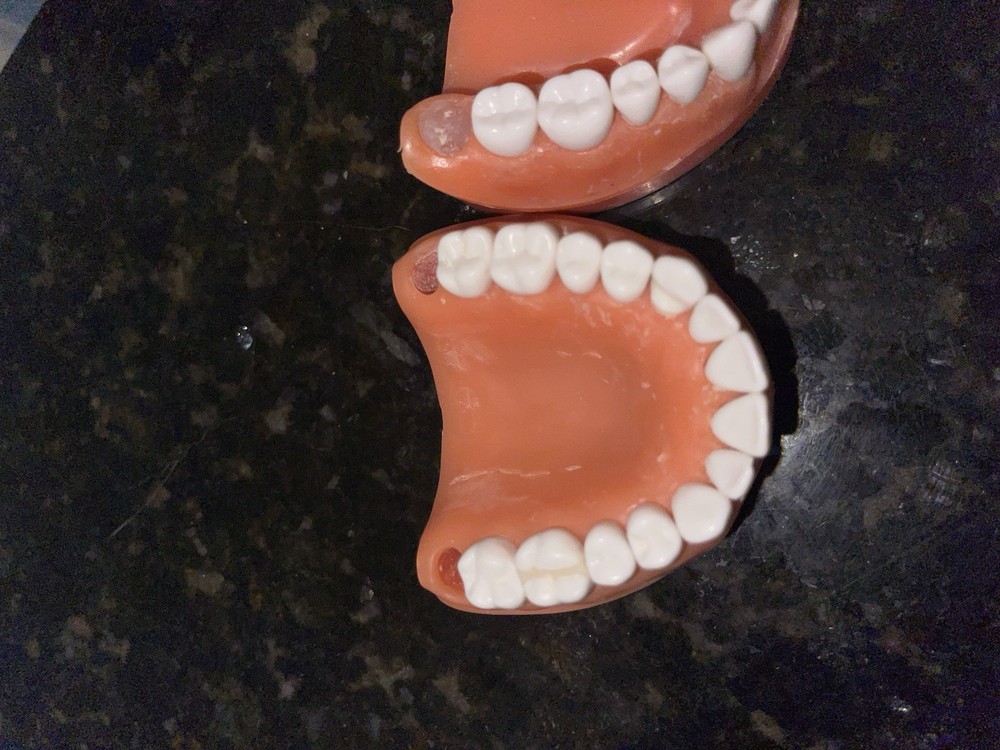 TWO Acadental ModuPRO One MP_R320 ADEX CDCA