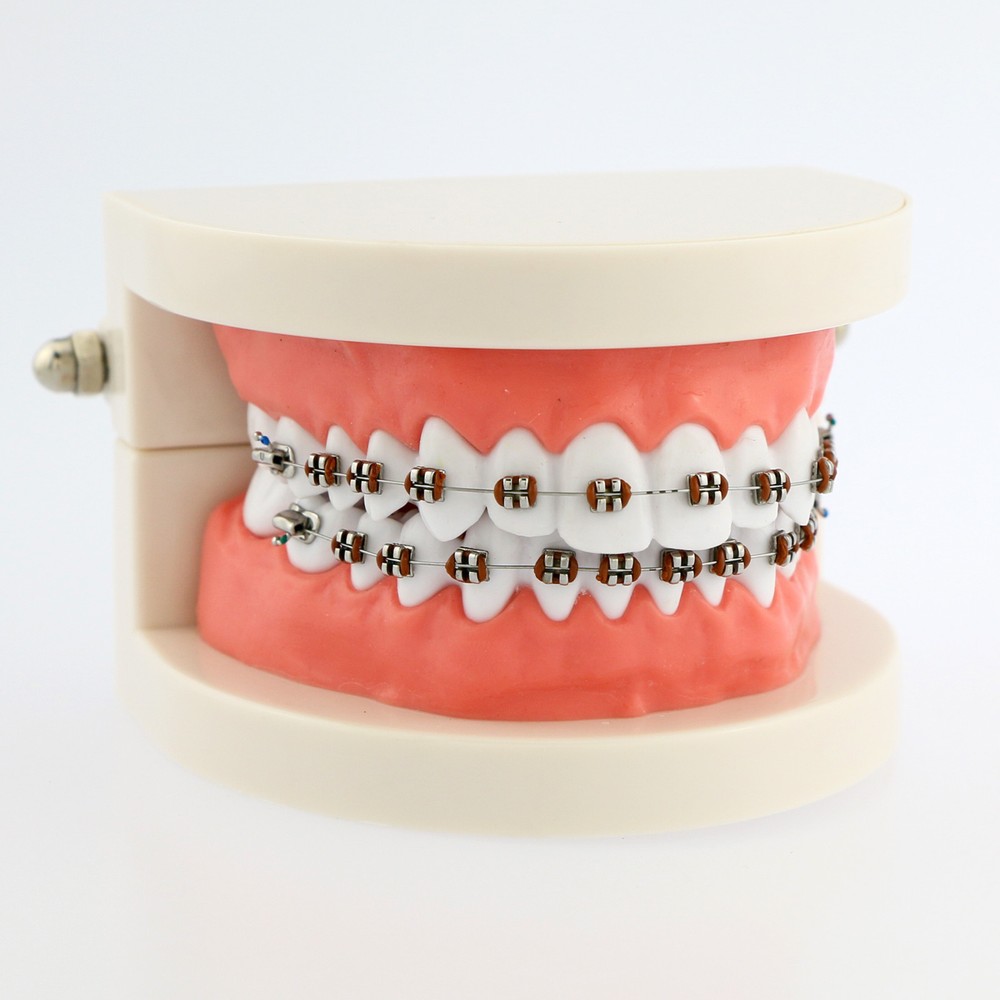 Dental Teach Typodont Demonstration Teeth Model with Braces For Patient Studying