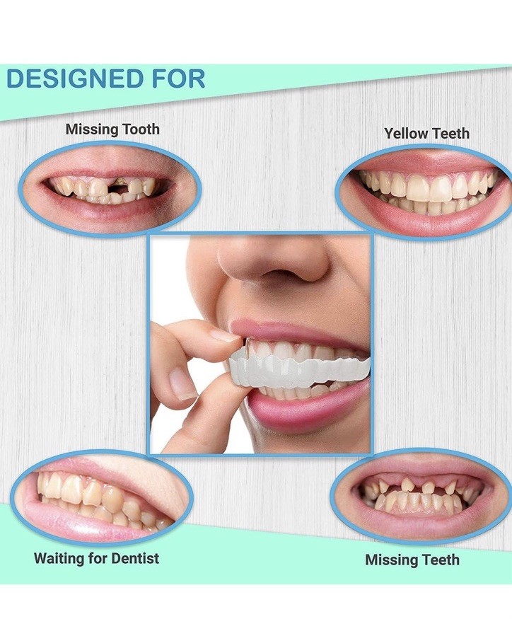 Sotiras Smile Veneers