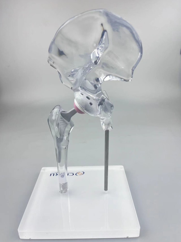 Transparent 1/3 Artificial Hip Joint Replacement Medical Anatomical Demo Model