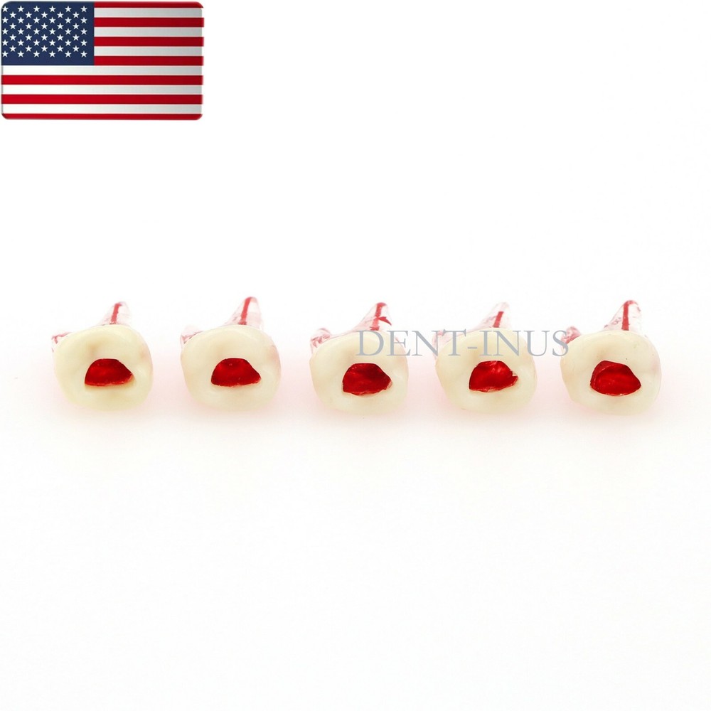US Dental Endo Molar Root Canal Study Practice Block Pulp Cavity Model RCT/MTA