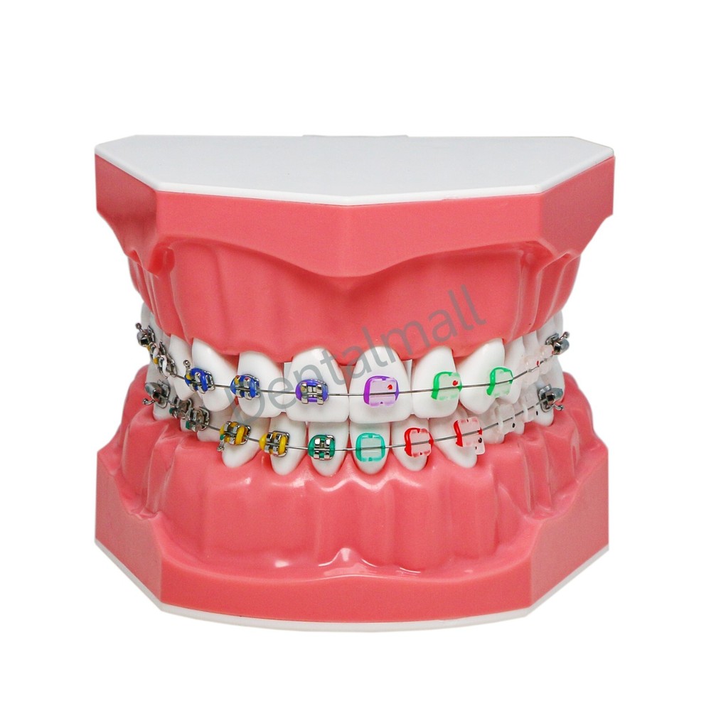 Dental 1:1 Teach Study Typodont Teeth Model Half Metal Ceramic Brackets Tubes