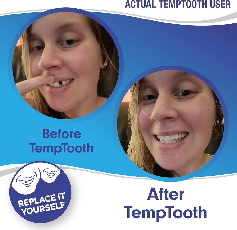 Temporary Tooth Replacement Kit Moldable Approved Easy Fix for Missing Teeth