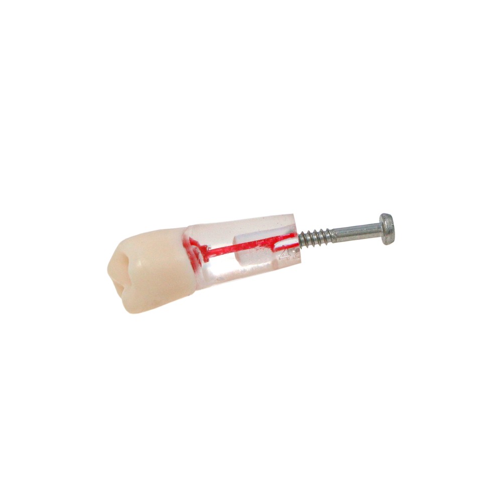 10Pcs Dental Root Teeth Canal Pulp Cavity RCT Endodontic Practice Teeth Model