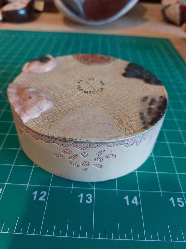 Skin Cancer Lesion Model