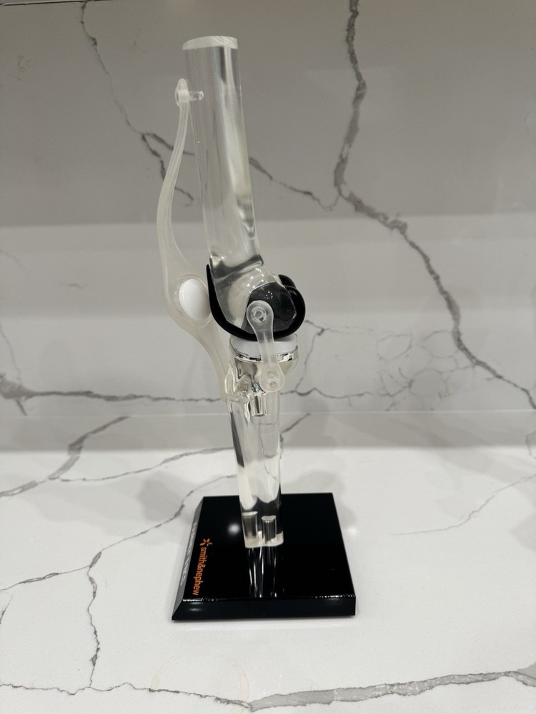 Total Knee Replacement Implant Model