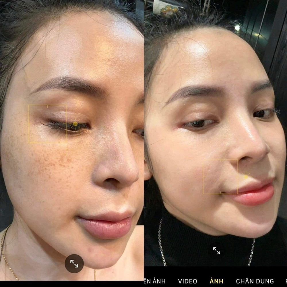 TEMP:31 Ultimate Moisture Essence + Repair Cream + Formula Cream
