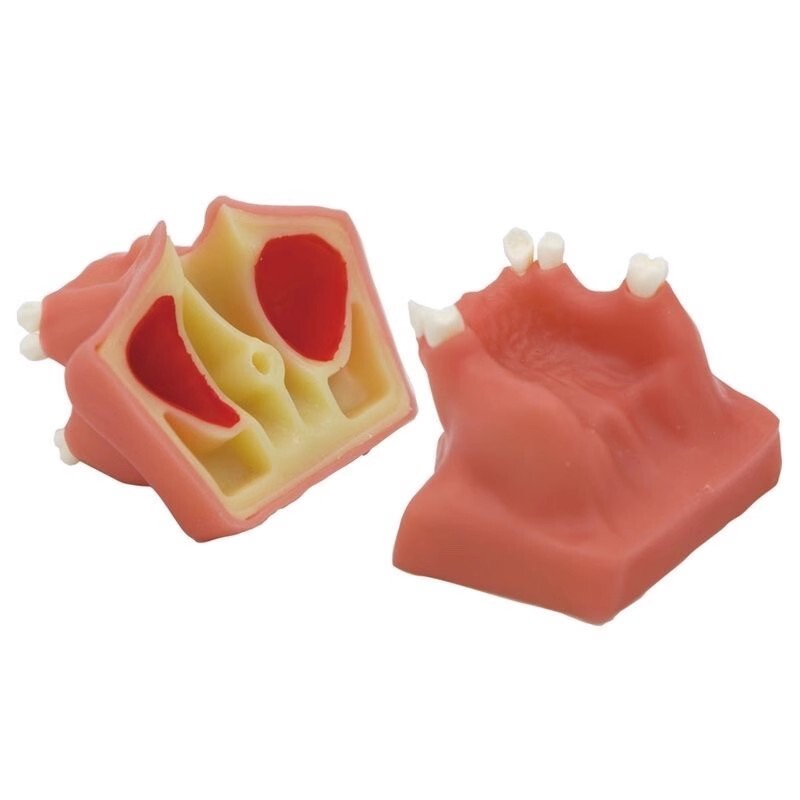 Dental Maxillary Sinus Lift Model Typodont Practice Model Show