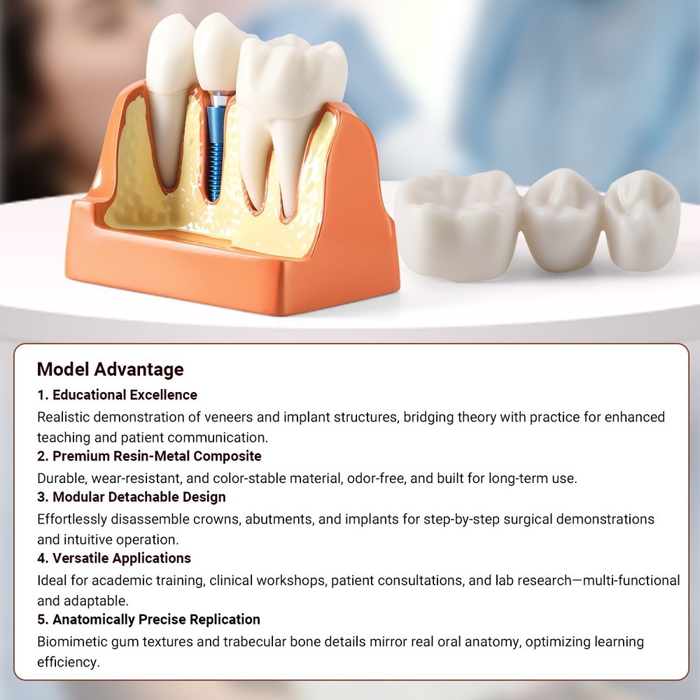 4 Times Dental Teeth Model Implant Crown Bridge Removable Study Teaching Tool