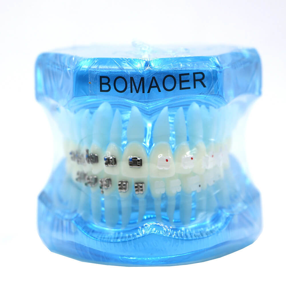 Dental Orthodontic Study Model with Metal & Ceramic Brackets for Teaching
