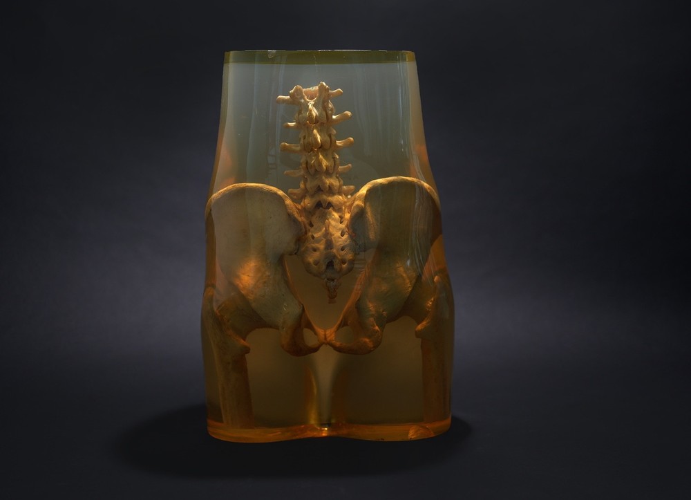 3M Xray Calibration Phantom Pelvis C.1960's