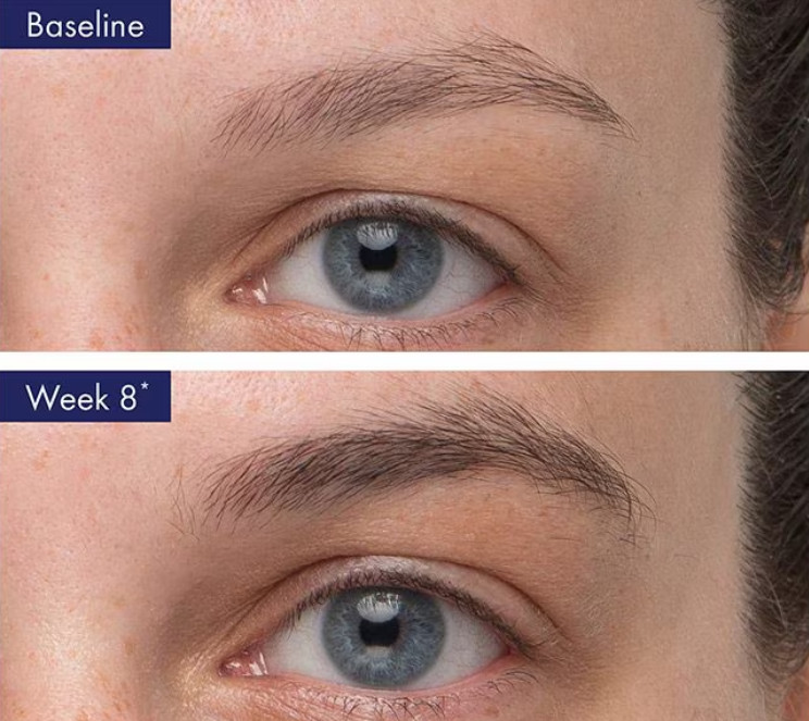 Obagi Nu-Cil™ Eyebrow Boosting Serum 0.17 fl oz