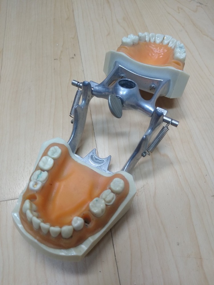 Columbia Dental Typodont Teeth Model R861 with Removable Teeth (missing 5 teeth)