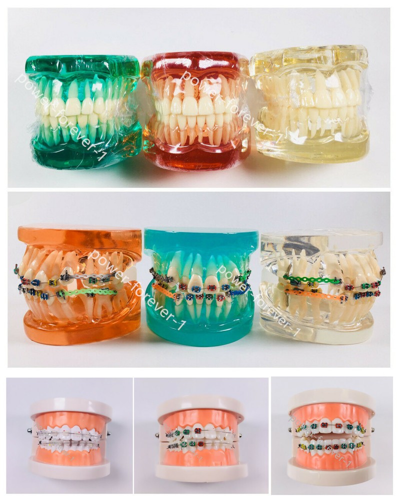 Dental Model Study Typodont Standard Orthodontic Brackets Wires Tie Anchor Screw