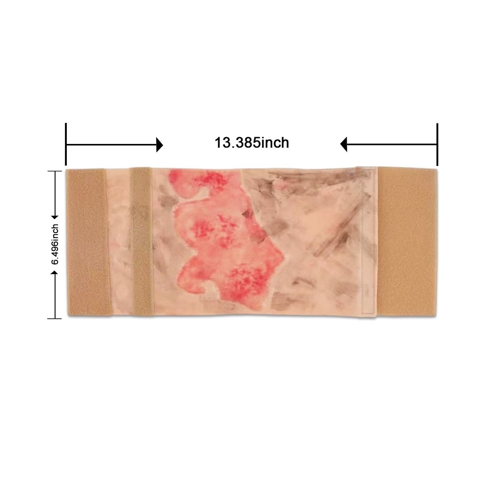 Limbs Burn Model, with Realistic Wound Simulation Module,Medical First Aid Train