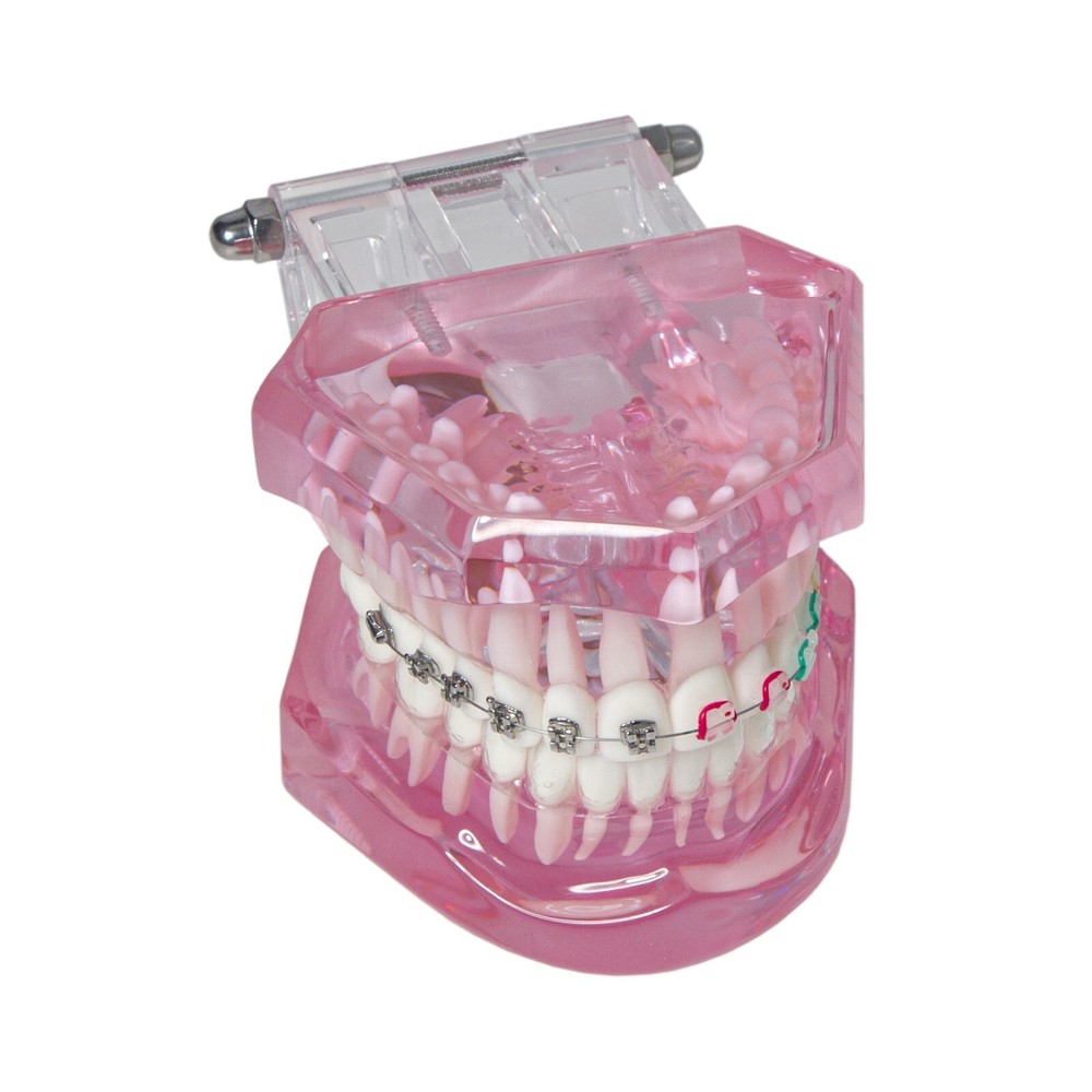 Dental Ortho Study Teach Teeth Model With Ceramic & Metal Brackets M3012 Pink