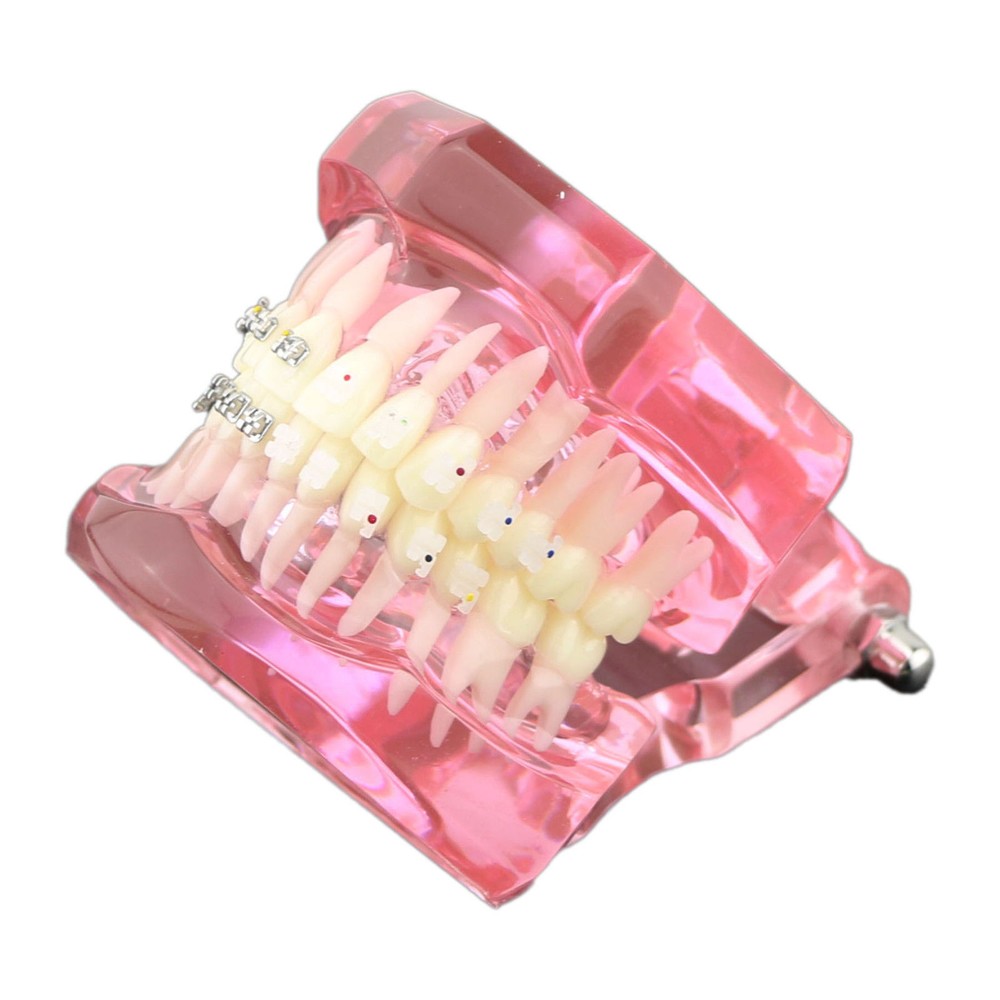 Dental OrthodonticCeramic Brackets 3003 Teeth Study Treatment Model With Metal