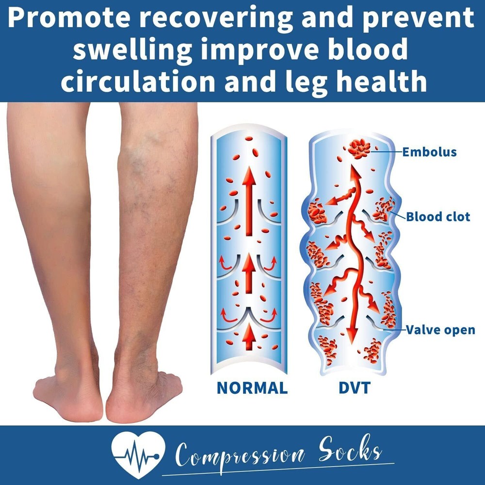 Zippered Compression Socks Open Toe Knee High Circulation Easy On/Off