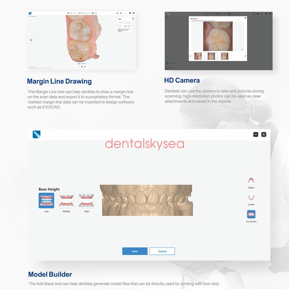 Dental Scanner 3D Scanning Function Dentistry Intraoral Scanner Real Color