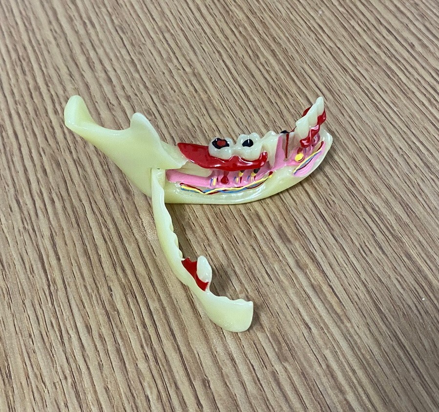 Dental Mandibular Tissue Teeth Anatomical Model Patient Teach Study Model