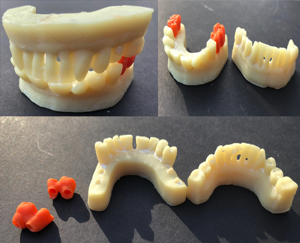 ALPHASENSE 3D DENTAL MODEL RESIN (500 ML)