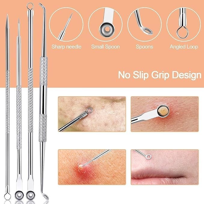 Professional Blackhead Remover Tool Kit - Acne Needle & Tweezer Extractor