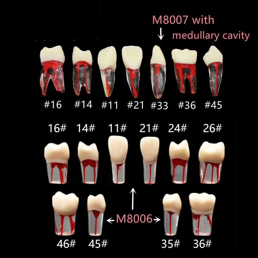36 Types Dental Canal Teeth Practice Model Block RCT Pulp Cavity Training Study