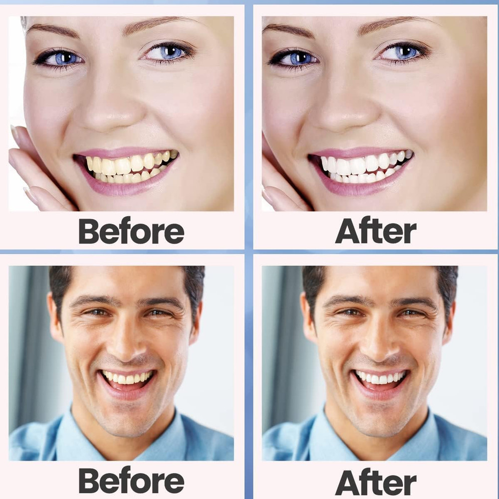 Teeth Whitening Strips, 28 Pcs Whitening Strips for Teeth Sensitive, Effective a
