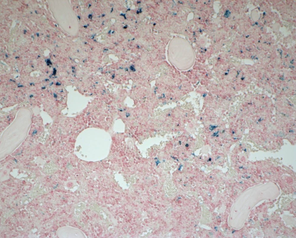 VitroView™ Prussian Blue Stain Kit (Cat# VB-3009)