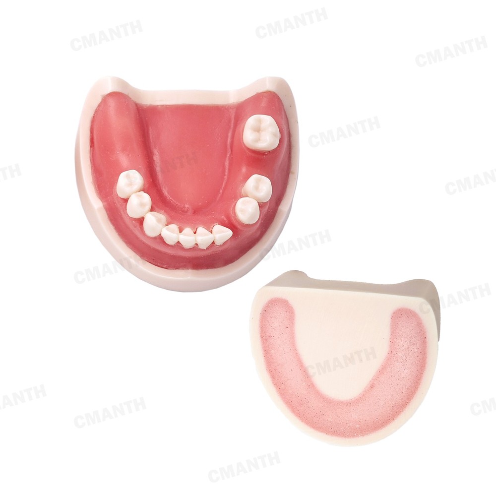 US Dental Teeth Implant Model Soft Gums Model Drilling Open Suture Practice