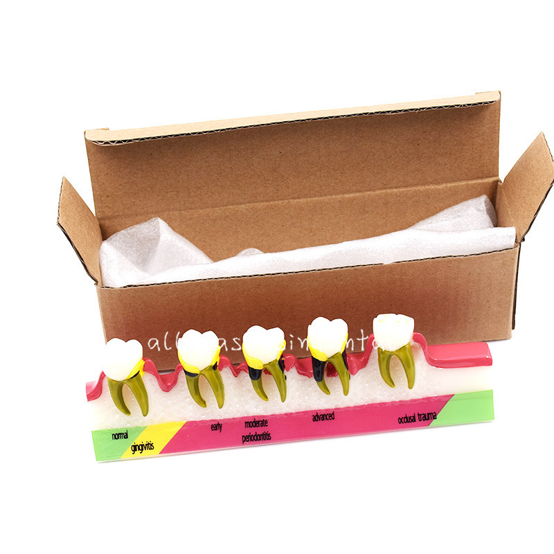 Dental Study Teaching Model Periodontal Disease Assort Teeth Dentoform Typodont