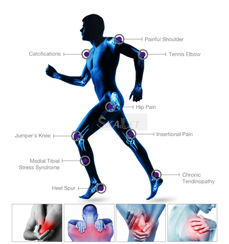 Focus Shockwave Eswt Focused Shock Wave Therapy Machine Pain Relief Physio