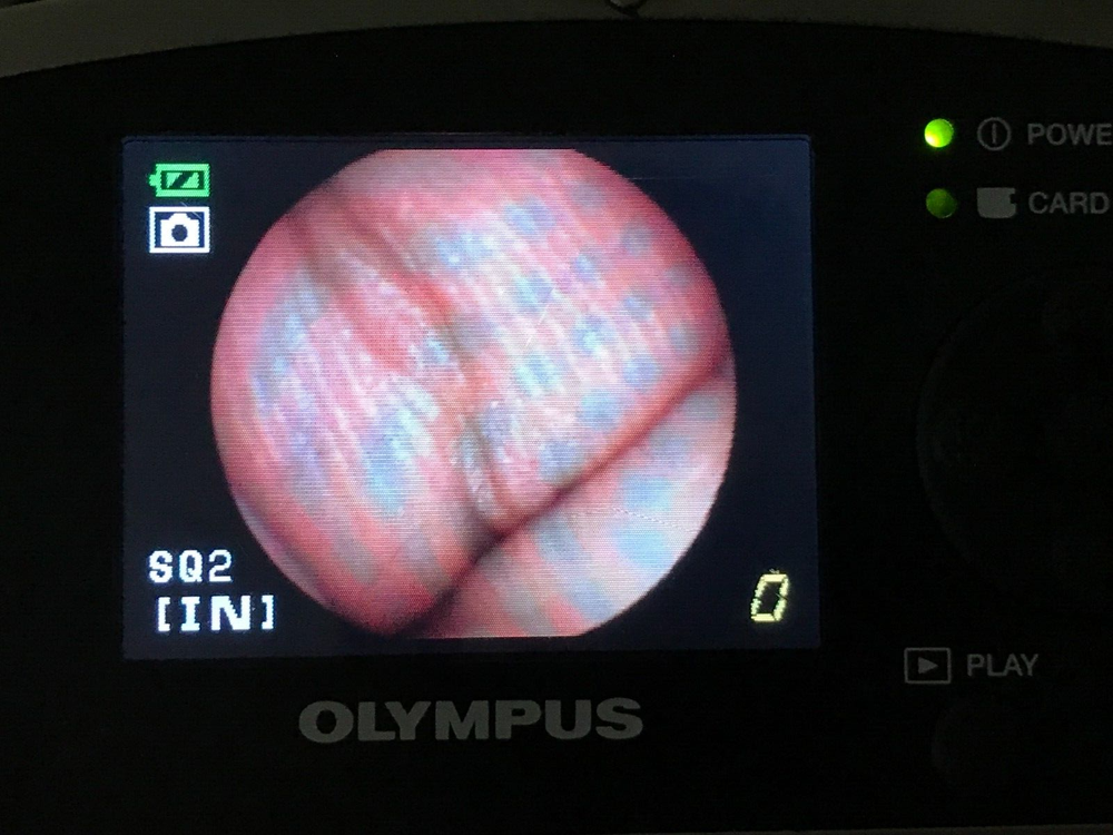 Olympus MAF-GM Intubation Endoscope Endoscopy (3954-s37)_