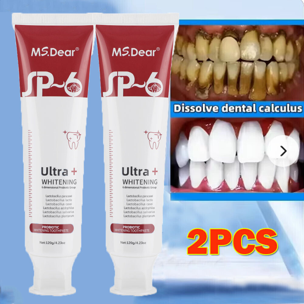 2Pcs Super Probiotic SP-6 Toothpaste, Probiotics Bright White Toothpaste, Sp 6