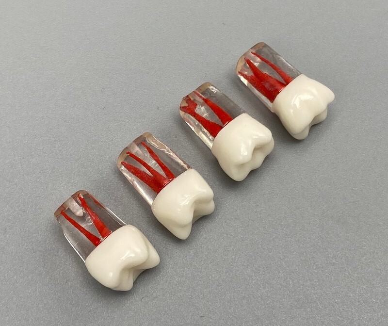 5pcs Dental Root Canal Teeth Study Practice Model Endodontic RCT Endo Pulp File
