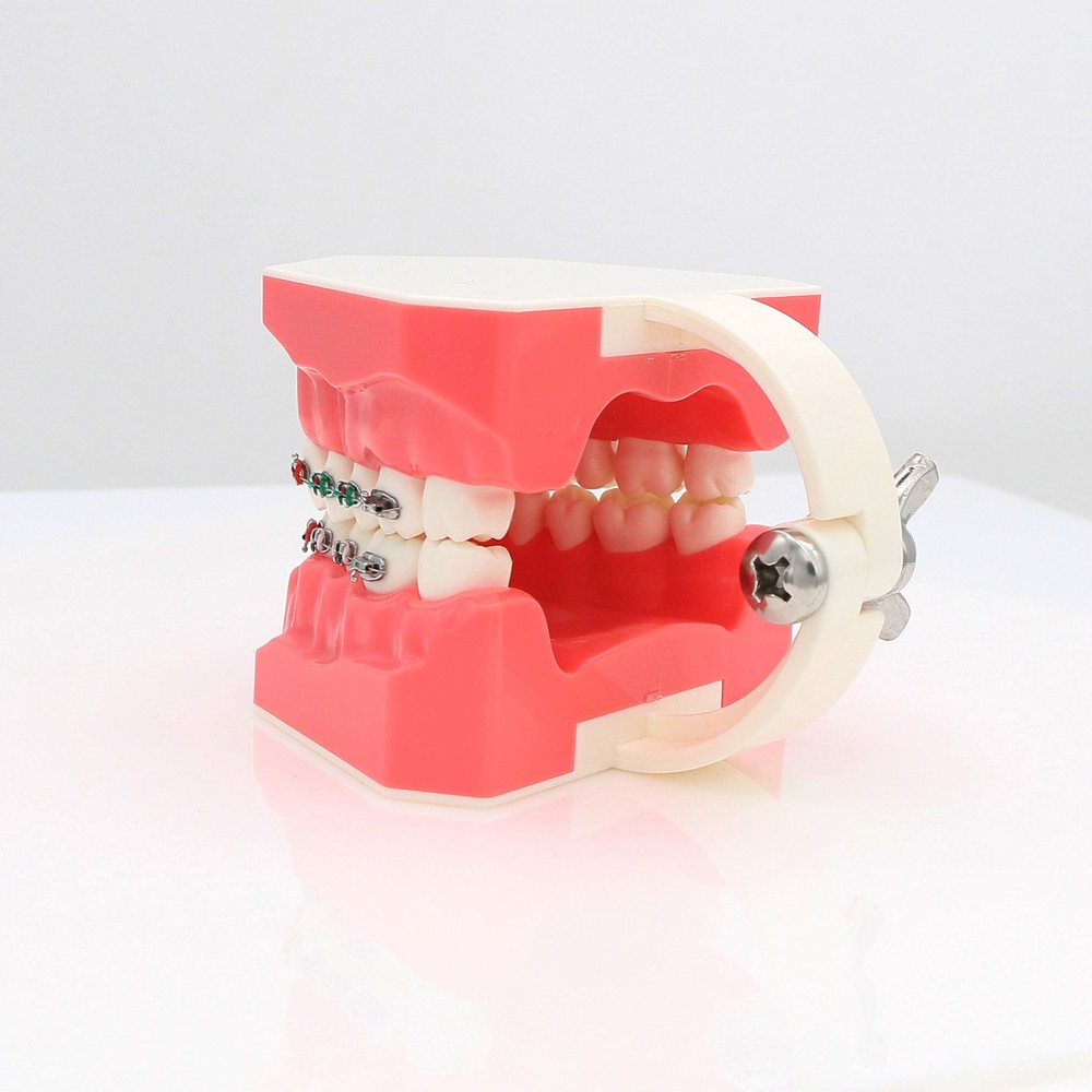 US Dental Typodont Demonstration Teach Teeth Model with Braces For Patient Study
