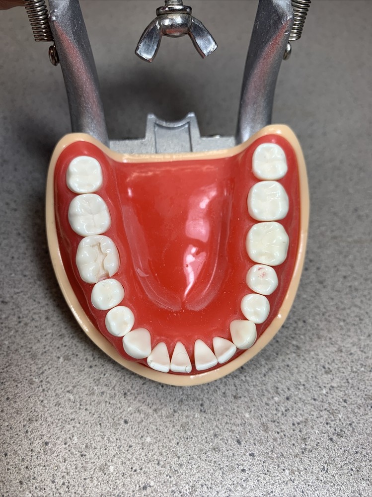 Dental Typodont Model With Removable Teeth Unbranded