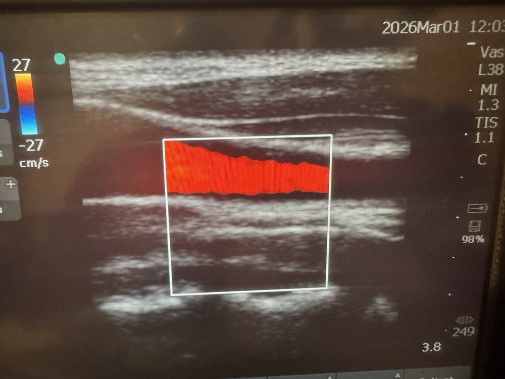 SonoSite L38n/10-5 MHz Linear Array Transducer Probe