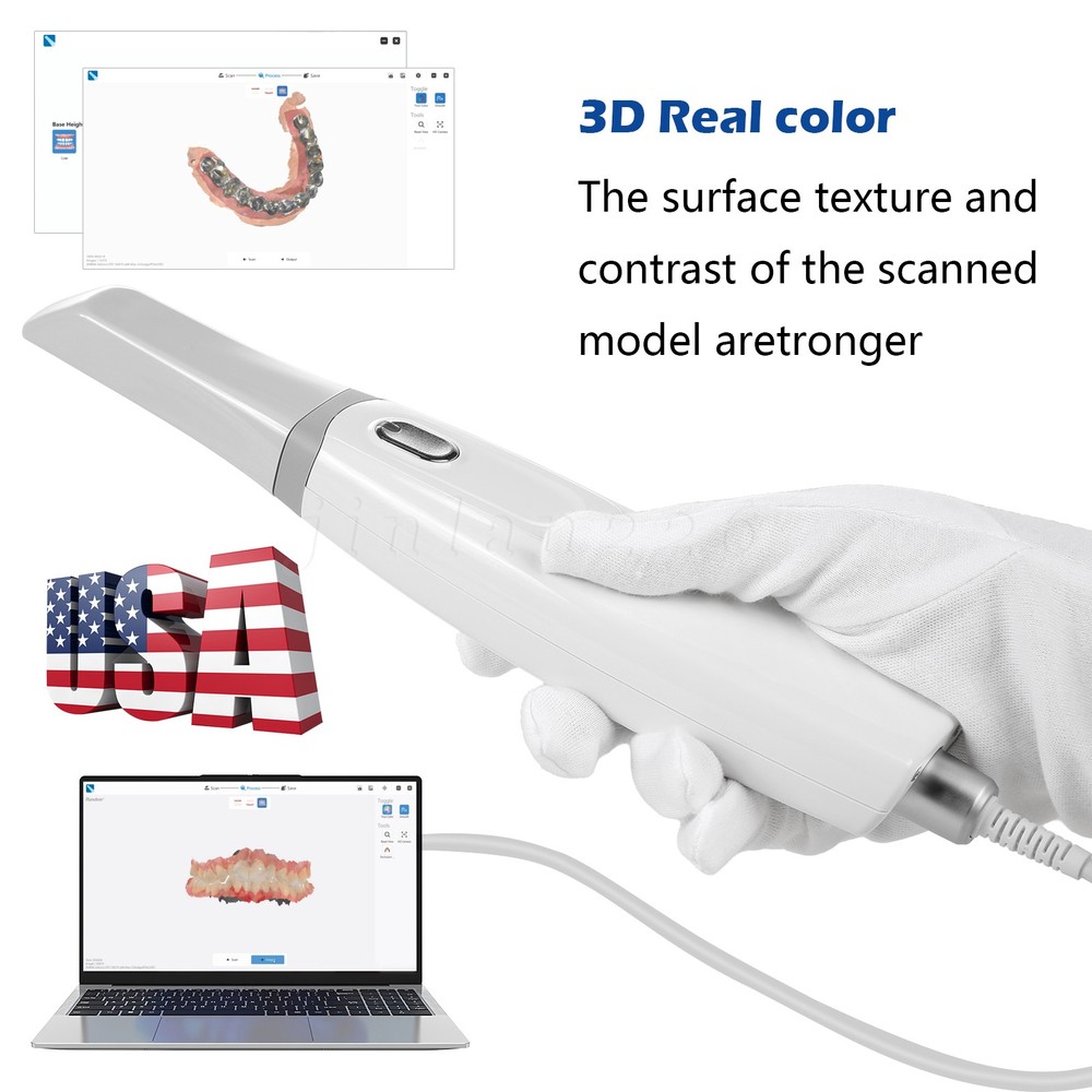 Dental Intra-oral 3D Scanner - with Scanning Software